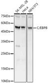 Anti-C/EBP beta antibody used in Western Blot (WB). GTX64382