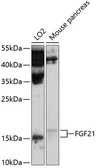 Anti-FGF21 antibody used in Western Blot (WB). GTX64384