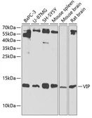 Anti-VIP antibody used in Western Blot (WB). GTX64386