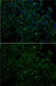 Anti-Angiogenin antibody used in Immunocytochemistry/ Immunofluorescence (ICC/IF). GTX64392