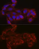 Anti-EIF4E2 antibody used in Immunocytochemistry/ Immunofluorescence (ICC/IF). GTX64395