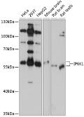Anti-IP6K1 antibody used in Western Blot (WB). GTX64396