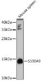 Anti-S100A9 antibody used in Western Blot (WB). GTX64397