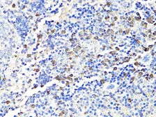 Anti-S100A9 antibody used in IHC (Paraffin sections) (IHC-P). GTX64397