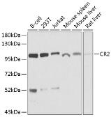 Anti-CD21 antibody used in Western Blot (WB). GTX64400
