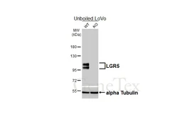 Anti-LGR5 antibody [HL4443] used in Western Blot (WB). GTX644008