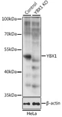Anti-YB1 antibody used in Western Blot (WB). GTX64401