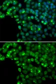 Anti-MGMT antibody used in Immunocytochemistry/ Immunofluorescence (ICC/IF). GTX64402