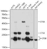 Anti-Cathepsin B antibody used in Western Blot (WB). GTX64404