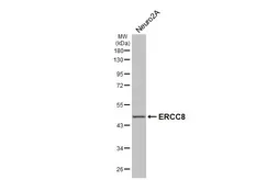 Anti-ERCC8 antibody [HL4475] used in Western Blot (WB). GTX644040