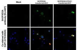 Anti-SH3PXD2A antibody [HL4487] used in IHC-P (cell pellet) (IHC-P (cell pellet)). GTX644054