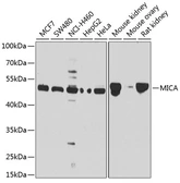 Anti-MICA antibody used in Western Blot (WB). GTX64407