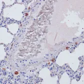 Anti-Perforin antibody used in IHC (Paraffin sections) (IHC-P). GTX64408