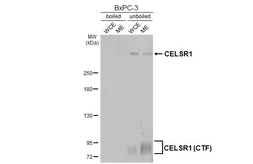 Anti-CELSR1 antibody [HL4515] used in Western Blot (WB). GTX644085