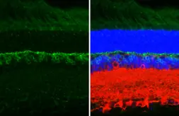 Anti-mGluR6 antibody [HL4516] used in IHC (Paraffin sections) (IHC-P). GTX644086