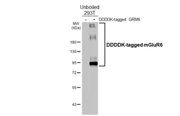 Anti-mGluR6 antibody [HL4518] used in Western Blot (WB). GTX644088