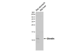 Anti-Ghrelin antibody [HL4526] used in Western Blot (WB). GTX644096