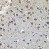 Anti-n-Myc antibody used in IHC (Paraffin sections) (IHC-P). GTX64413
