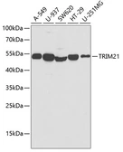 Anti-SSA1 antibody used in Western Blot (WB). GTX64414