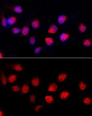 Anti-ADAR1 antibody used in Immunocytochemistry/ Immunofluorescence (ICC/IF). GTX64415