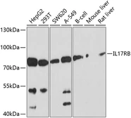 Anti-IL17 Receptor beta antibody used in Western Blot (WB). GTX64417