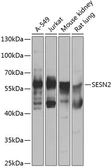 Anti-SESN2 antibody used in Western Blot (WB). GTX64418
