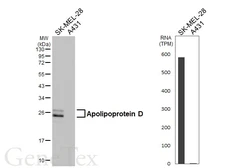 Anti-Apolipoprotein D antibody [HL4532] used in Western Blot (WB). GTX644200