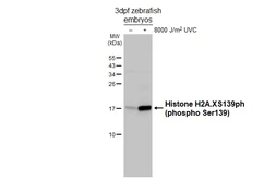 Anti-Histone H2A.XS139ph (phospho Ser139) antibody [HL4533] used in Western Blot (WB). GTX644201