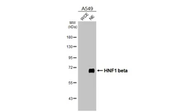Anti-HNF1 beta antibody [HL4538] used in Western Blot (WB). GTX644206