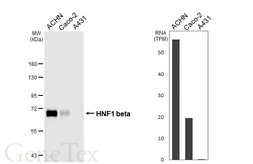 Anti-HNF1 beta antibody [HL4538] used in Western Blot (WB). GTX644206
