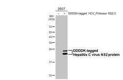 Anti-Hepatitis C virus NS2 protein antibody [HL4539] used in Western Blot (WB). GTX644207