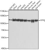 Anti-SFPQ antibody used in Western Blot (WB). GTX64421