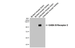 Anti-GABA B Receptor 2 antibody [HL4551] used in Western Blot (WB). GTX644219