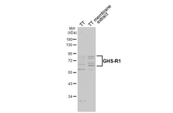 Anti-GHS-R1 antibody [HL4566] used in Western Blot (WB). GTX644234