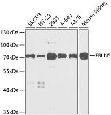 Anti-Fibulin 5 antibody used in Western Blot (WB). GTX64424