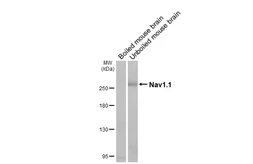 Anti-Nav1.1 antibody [GT230] used in Western Blot (WB). GTX644240