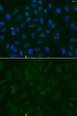 Anti-Sodium/Potassium ATPase alpha 1 antibody used in Immunocytochemistry/ Immunofluorescence (ICC/IF). GTX64425