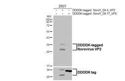 Anti-Norovirus VP2 antibody [HL4580] used in Western Blot (WB). GTX644256
