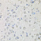Anti-CD97 antibody used in IHC (Paraffin sections) (IHC-P). GTX64426