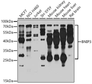 Anti-BNIP3 antibody used in Western Blot (WB). GTX64429