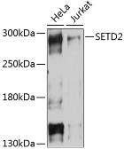 Anti-HYPB/SETD2 antibody used in Western Blot (WB). GTX64430