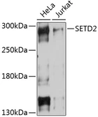 Anti-HYPB/SETD2 antibody used in Western Blot (WB). GTX64430