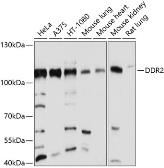 Anti-DDR2 antibody used in Western Blot (WB). GTX64433