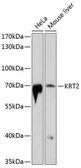 Anti-Cytokeratin 2 antibody used in Western Blot (WB). GTX64434