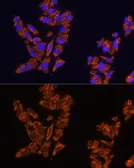 Anti-SIRP alpha antibody used in Immunocytochemistry/ Immunofluorescence (ICC/IF). GTX64435