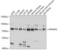 Anti-XPNPEP2 antibody used in Western Blot (WB). GTX64436