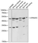 Anti-Renin Receptor antibody used in Western Blot (WB). GTX64438