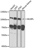 Anti-ChREBP antibody used in Western Blot (WB). GTX64439