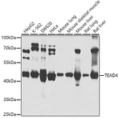 Anti-TEAD4 antibody used in Western Blot (WB). GTX64441