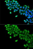 Anti-Vitamin D Binding Protein antibody used in Immunocytochemistry/ Immunofluorescence (ICC/IF). GTX64444